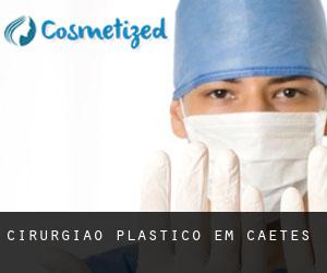 Cirurgião Plástico em Caetés