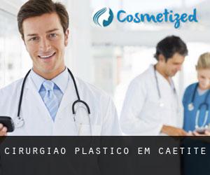 Cirurgião Plástico em Caetité