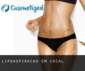 Lipoaspiração em Cocal Lipoaspiração em Cocal