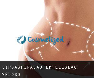 Lipoaspiração em Elesbão Veloso