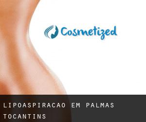 Lipoaspiração em Palmas (Tocantins)