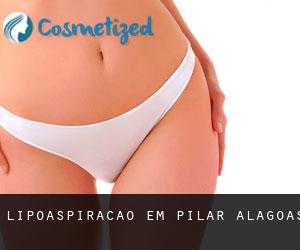 Lipoaspiração em Pilar (Alagoas)