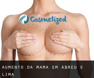 Aumento da mama em Abreu e Lima