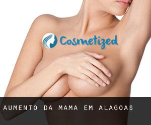 Aumento da mama em Alagoas