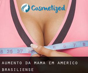 Aumento da mama em Américo Brasiliense