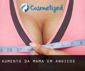 Aumento da mama em Angicos