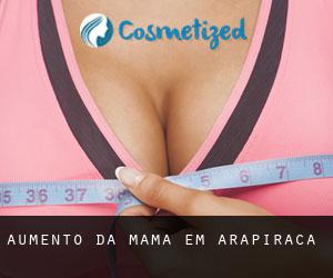 Aumento da mama em Arapiraca