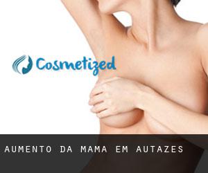 Aumento da mama em Autazes Aumento da mama em Autazes