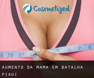 Aumento da mama em Batalha (Piauí)