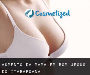 Aumento da mama em Bom Jesus do Itabapoana