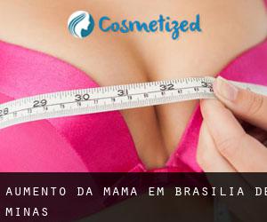 Aumento da mama em Brasília de Minas
