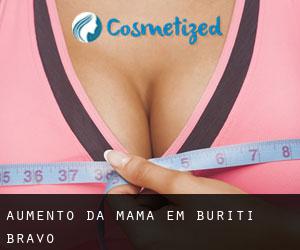 Aumento da mama em Buriti Bravo