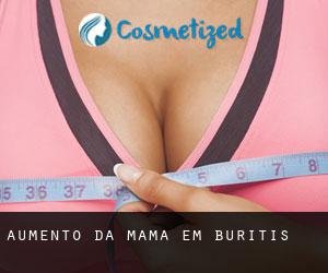 Aumento da mama em Buritis