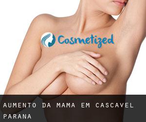 Aumento da mama em Cascavel (Paraná)
