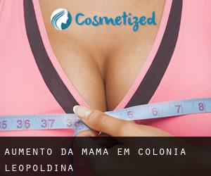 Aumento da mama em Colônia Leopoldina