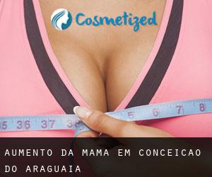 Aumento da mama em Conceição do Araguaia