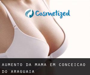Aumento da mama em Conceição do Araguaia
