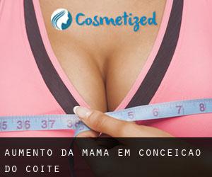 Aumento da mama em Conceição do Coité
