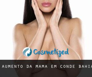 Aumento da mama em Conde (Bahia)