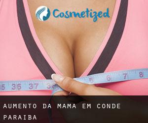 Aumento da mama em Conde (Paraíba)
