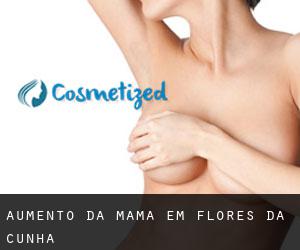 Aumento da mama em Flores da Cunha