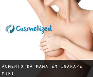 Aumento da mama em Igarapé-Miri