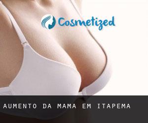 Aumento da mama em Itapema
