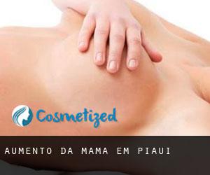 Aumento da mama em Piauí Aumento da mama em Piauí
