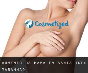 Aumento da mama em Santa Inês (Maranhão)