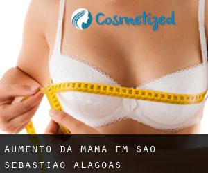 Aumento da mama em São Sebastião (Alagoas)