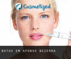 Botox em Afonso Bezerra