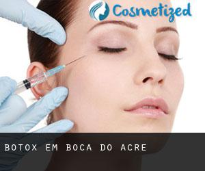 Botox em Boca do Acre