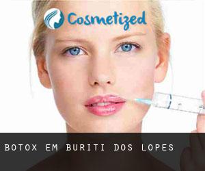 Botox em Buriti dos Lopes