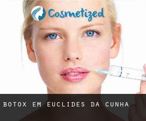 Botox em Euclides da Cunha
