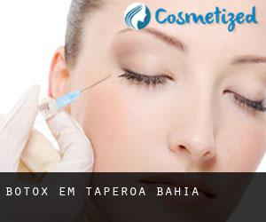 Botox em Taperoá (Bahia)