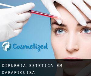 Cirurgia Estética em Carapicuíba