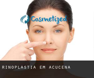 Rinoplastia em Açucena