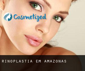 Rinoplastia em Amazonas Rinoplastia em Amazonas