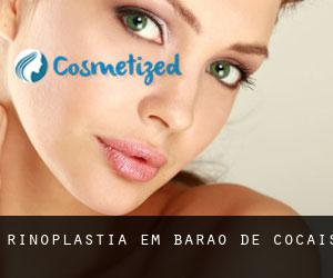 Rinoplastia em Barão de Cocais Rinoplastia em Barão de Cocais