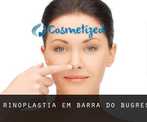 Rinoplastia em Barra do Bugres Rinoplastia em Barra do Bugres