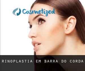 Rinoplastia em Barra do Corda Rinoplastia em Barra do Corda