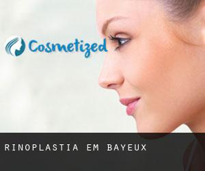 Rinoplastia em Bayeux Rinoplastia em Bayeux