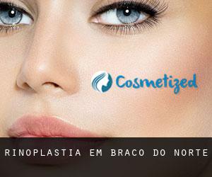 Rinoplastia em Braço do Norte