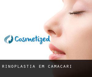 Rinoplastia em Camaçari Rinoplastia em Camaçari