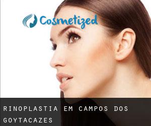 Rinoplastia em Campos dos Goytacazes Rinoplastia em Campos dos Goytacazes