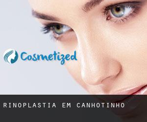 Rinoplastia em Canhotinho