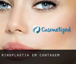 Rinoplastia em Contagem Rinoplastia em Contagem