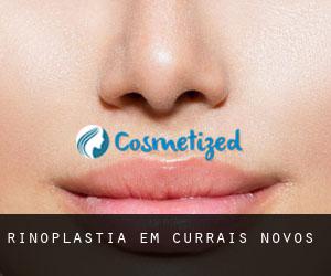 Rinoplastia em Currais Novos Rinoplastia em Currais Novos