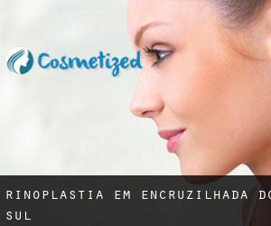 Rinoplastia em Encruzilhada do Sul Rinoplastia em Encruzilhada do Sul