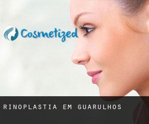 Rinoplastia em Guarulhos Rinoplastia em Guarulhos